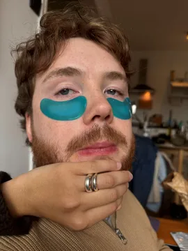 Joris wearing blue under-eye patches